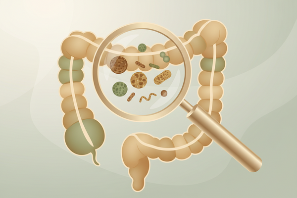 SIBO: What It Is and What to Do About It