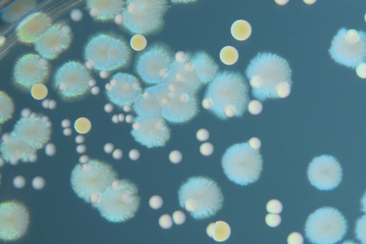 Petri dish with bacterial colonies